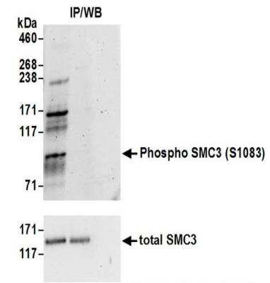 <b>Biological Strategies Validation. </b>Immunoprecipitation: SMC3 [p Ser103] Antibody [NBP2-37694] - Whole cell lysate (1mg for IP; 20% of IP loaded) from HeLa cells treated with 500 uM EPE for 4 hours (+). Antibodies: Phospho SMC3 was immunoprecipitated (IP) using rabbit anti-Phospho SMC3 (S1083) antibody. The IP reactions were either mock treated (-) or treated with phosphatases (+).  Affinity purified rabbit anti-Phospho SMC3 (S1083) antibody was used for western blot (WB) of IPs at 1 ug/ml (upper panel); to detect total SMC3 affinity purified rabbit anti-SMC3 was used for WB of IPs at 0.1 ug/ml  (lower panel).  Detection: Chemiluminescence with an exposure time of 3 minutes (upper panel) and 30 seconds (lower panel).